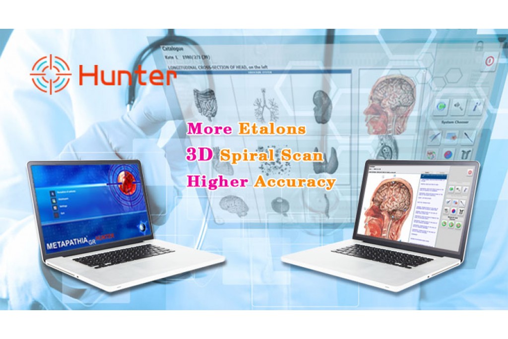 Meta Hunter - Leader in Modern Joint Pathology Diagnosis