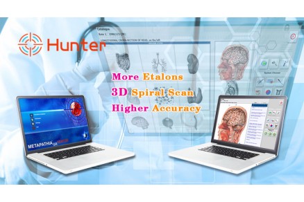 Metatron 4025 Hunter for Pancreatic Diseases